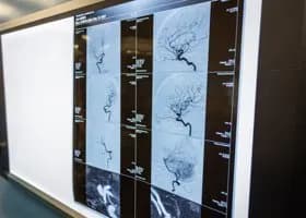 Диагностикой ямальцев занимается искусственный интеллект