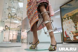 Курганские врачи выпрямили ноги девочке с уникальной болезнью — одну на 100 000. Фото