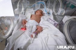 В Тюмени полугодовалый ребенок заразился менингококком