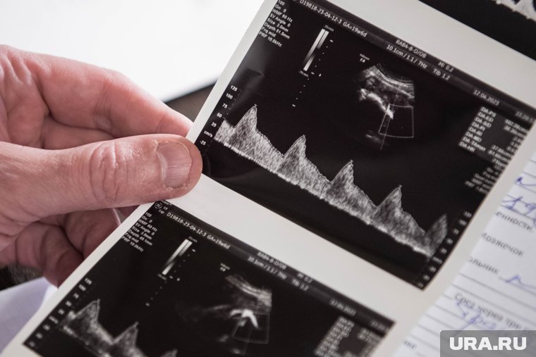 Рождаемость в России упала до самых низких показателей в современности. Видео