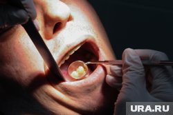 Стоматолог раскрыл, почему зубы желтеют