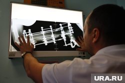 Курган богат талантами: врачи Центра Илизарова помогли молодому пациенту вновь начать ходить. Видео